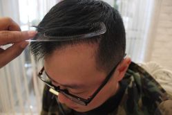 点击看大图 -大麦微针植发丨全国连锁