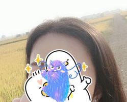 -大麦微针植发全国连锁