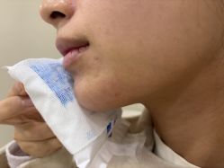 -长沙雅美医疗美容医院
