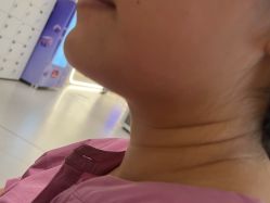 点击看大图 -广州美莱医疗美容医院