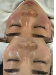 -美愈美肤MEIYU SKIN