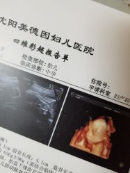 点击看大图 检查结果-美德因妇儿医院