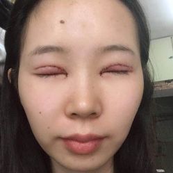 -西安壹加壹医疗美容医院