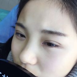 点击看大图 -西施无菌半永久纹绣眉眼影唇轻增发纹发际线