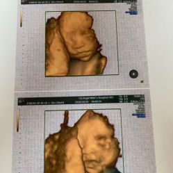 -重庆安琪儿妇产医院-妇幼保健联盟医院