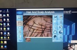 -雍禾植发全国连锁