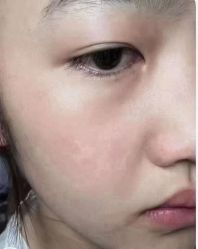 -+MS卓美丝专业祛痘·皮肤管理中心