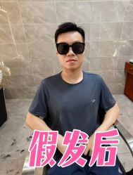 -唐风采假发补发定制