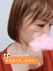 点击看大图 -Yestar宁波艺星整形医院