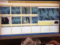 -丝客富脱发养发头皮馆