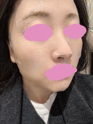 -张小熊连锁轻医美