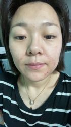-新美荟医美·专注面部美学抗衰