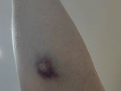 -北京市垂杨柳医院