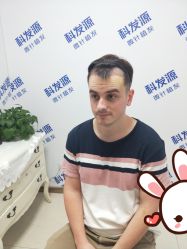 点击看大图 -大麦微针植发丨全国连锁