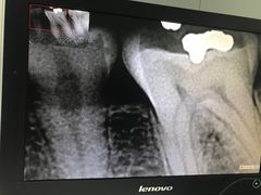 -武汉大学人民医院(首义院区)