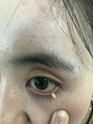 -痣清宫祛斑祛痣连锁店