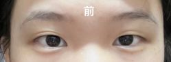 -杭州美莱医疗美容医院