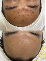-康美贞·痘肌养护管理中心