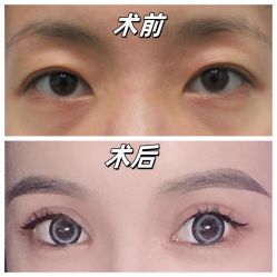-素美医疗美容·西南眼鼻整形·修复基地