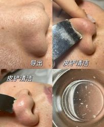 -春田皮肤管理中心品牌旗舰店