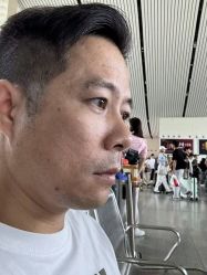 点击看大图 -广州健丽·去眼袋医疗美容机构