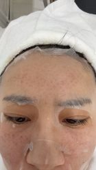 体验后-上海首尔丽格医疗美容医院