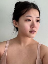 -四川米兰柏羽医学美容医院