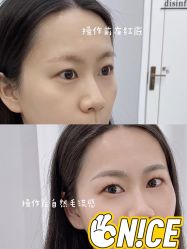 -久匠半永久纹眉