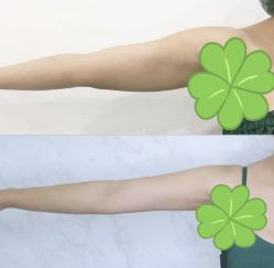 -Lily纤美·科技减脂中心