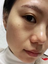体验后-禾丽康美医疗美容医院