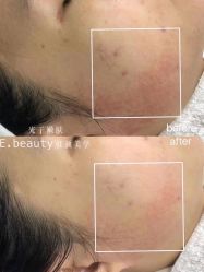 -E.beauty驻颜·痘敏肌调理中心