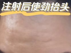 -圣嘉新医疗美容医院