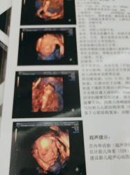 -艾博尔医院