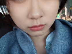 点击看大图 体验后-坤如玛丽·医疗美容中心