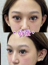 -深圳艺星医疗美容医院