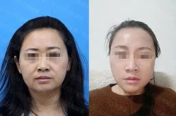 -加减美医美连锁品牌
