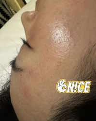 -清疣美疣·痣·斑净肤中心