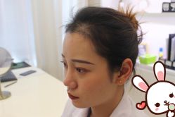 -大麦微针植发丨全国连锁