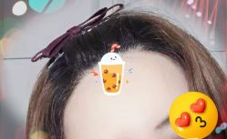 -大麦微针植发全国连锁