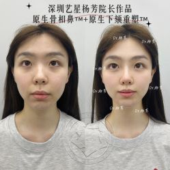 -深圳艺星医疗美容医院