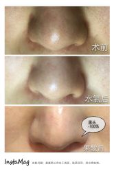 脸部抗衰-光SPA科技美肤