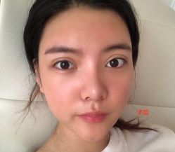 -广州健丽·去眼袋医疗美容机构