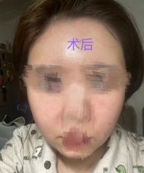 -杭州医巢医疗美容