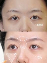 -Yestar重庆艺星医疗美容医院