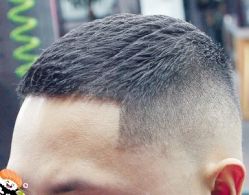 -大麦微针植发丨全国连锁