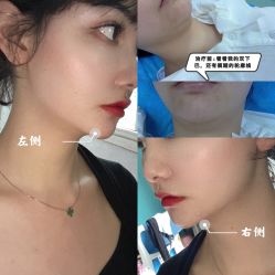体验前-成都大华医学美容医院