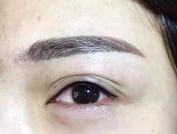 点击看大图 -郡艺医疗美容·微整·眼鼻吸脂