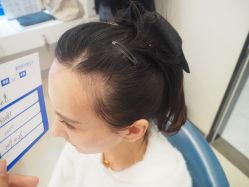 -大麦微针植发丨全国连锁