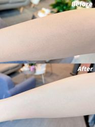 -植蔻妍倍儿专业脱毛·皮肤管理