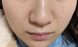 -安徽合肥韩美整形外科医院